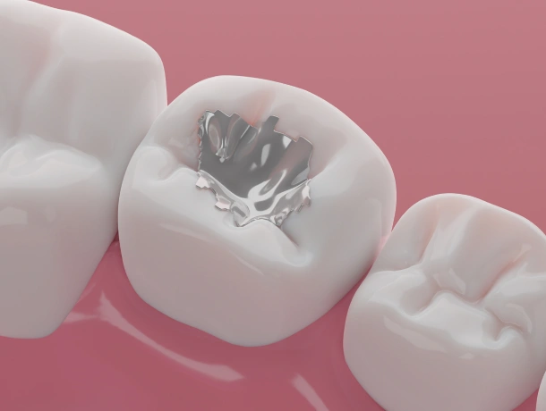 Three white dental crowns on pink background, one showing internal structure detail.