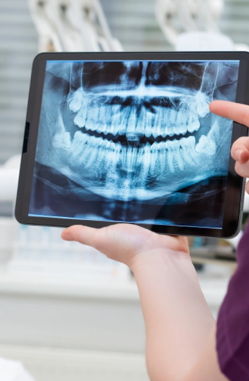 Digital-X-Rays
