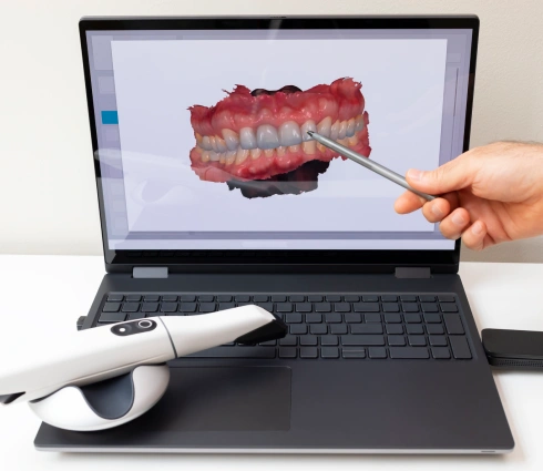 Intraoral-Scanner