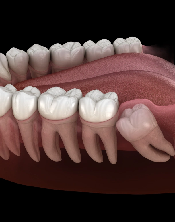 Dental anatomy illustration showing upper and lower teeth arrangement on gum model against dark background.