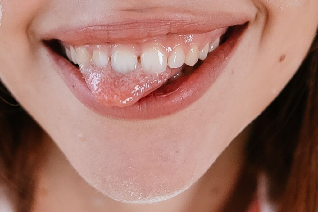 Healthy smile showing results of composite bonding as an alternative to veneers