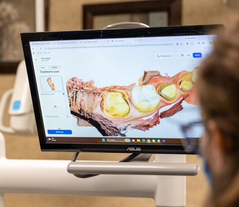Intraoral scanner displaying digital tooth scan